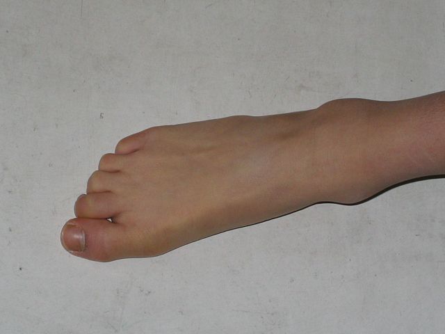 der Fuß